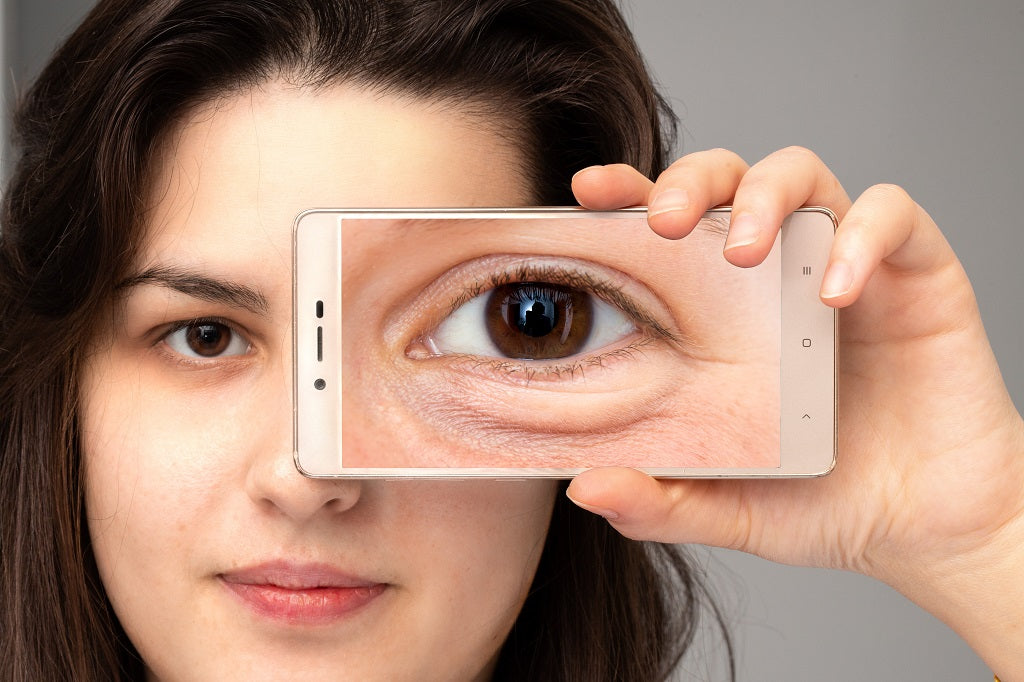 Everything You Need To Know About Under Eye Care