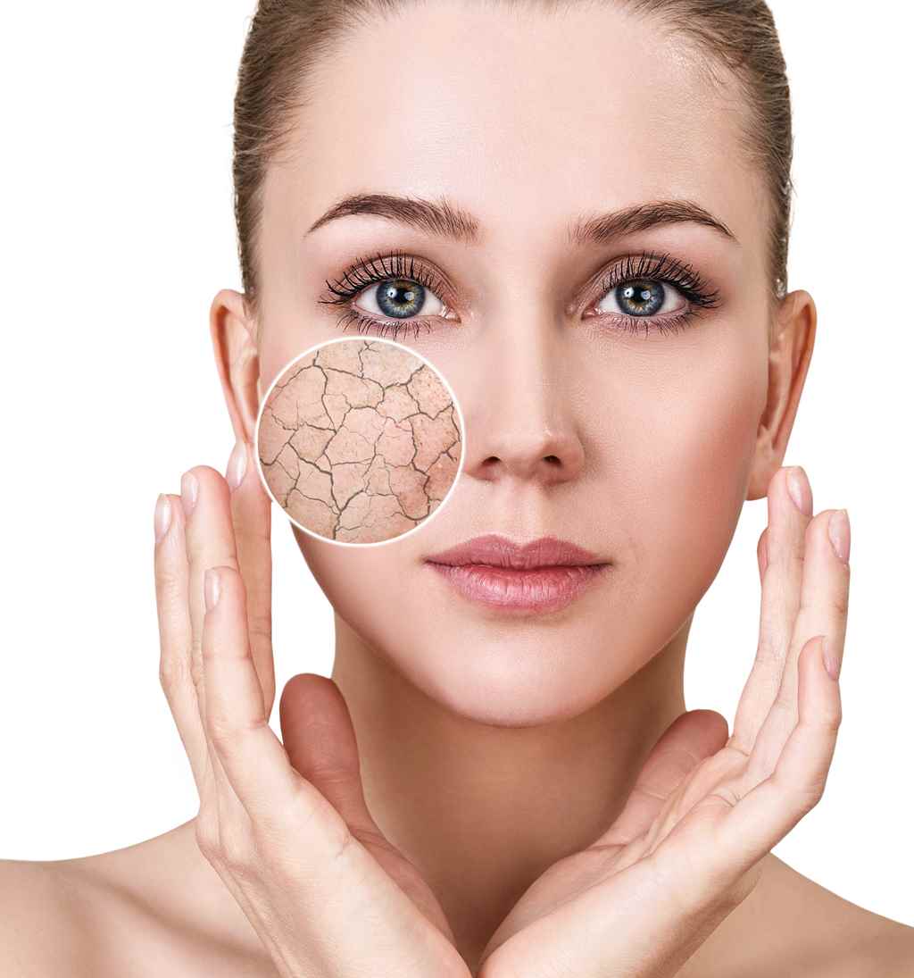 dry skin