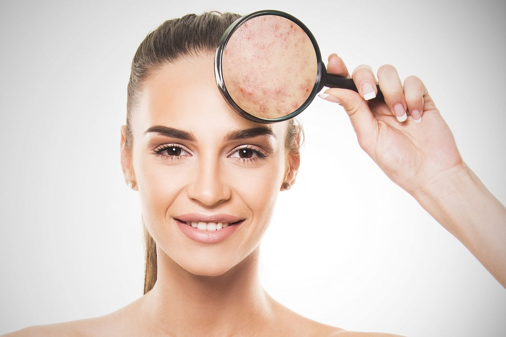 Simple Home Remedies To Repair Damaged Skin
