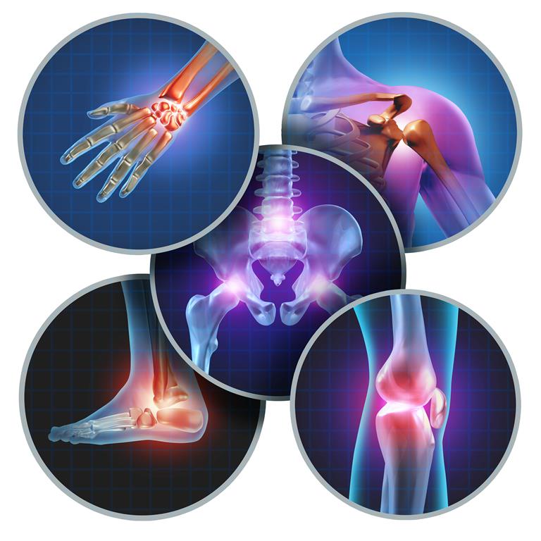 10 Effective Essential Oils For Arthritis