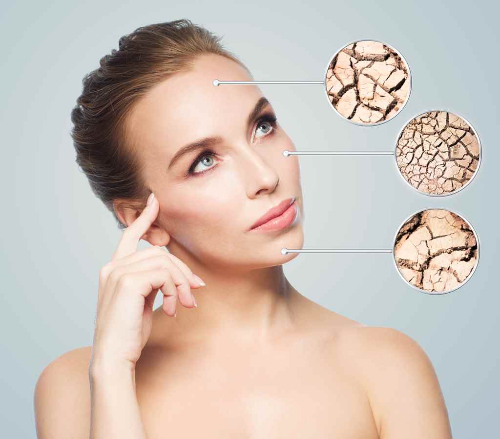dry skin