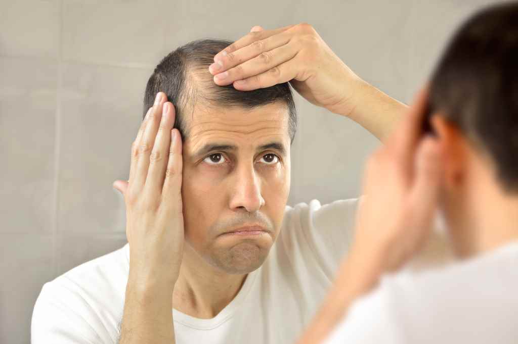 hair loss