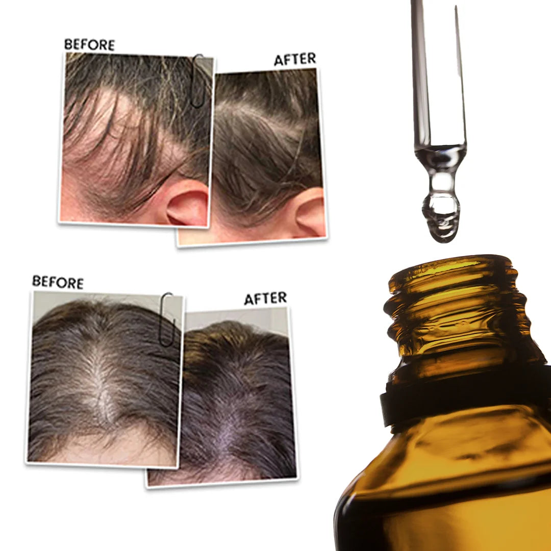 Rosemary Mint Hair Oil, 50 ml