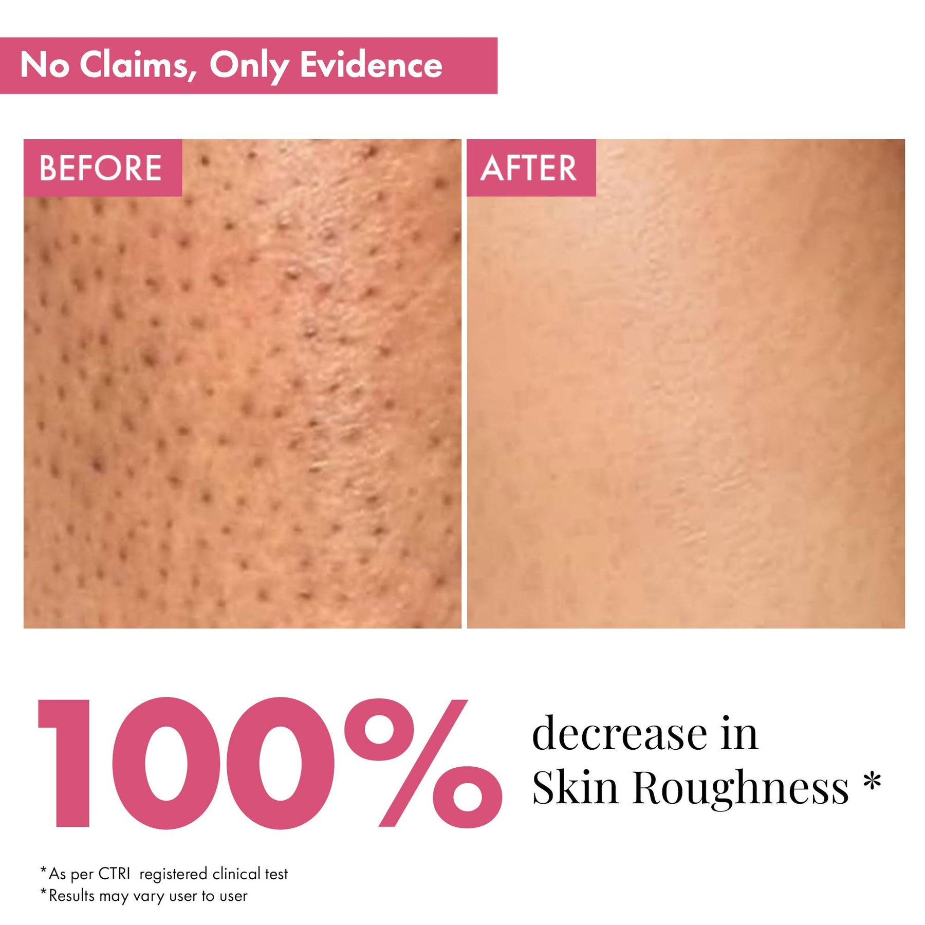 Skin Smoothening Bumps Eraser Exfoliating Body Scrub, 100ml