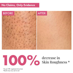 Skin Smoothening Bumps Eraser Exfoliating Body Scrub, 100ml