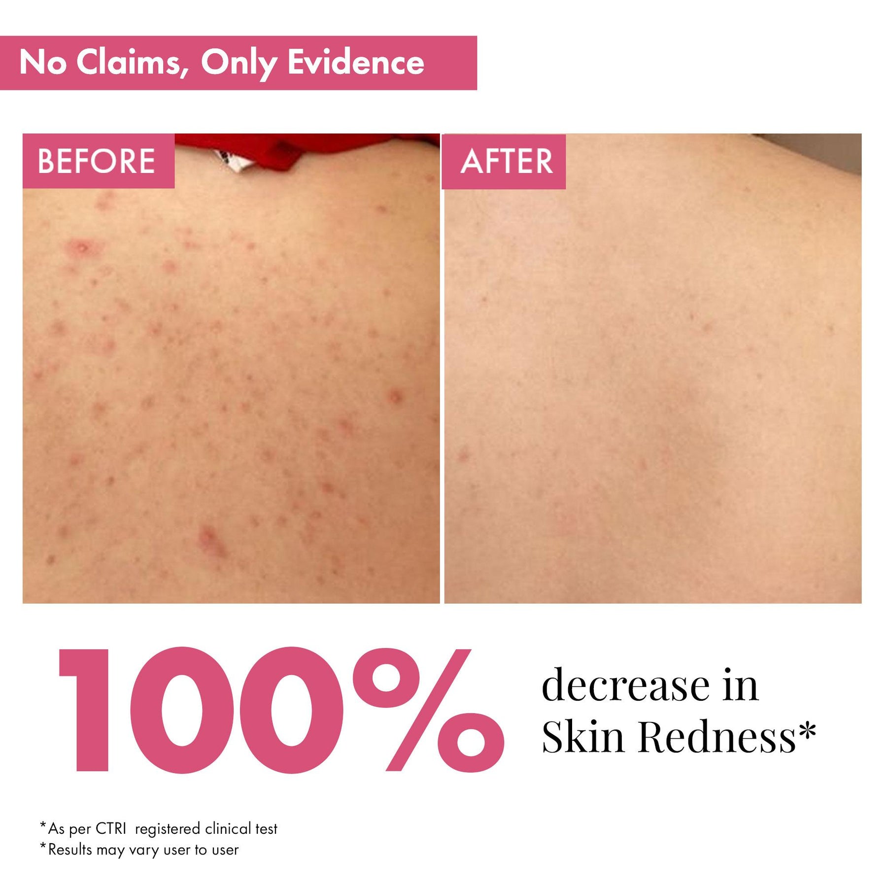 Skin Smoothening Bumps Eraser Exfoliating Body Scrub, 100ml