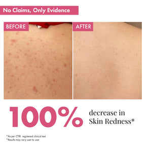 Skin Smoothening Bumps Eraser Exfoliating Body Scrub, 100ml