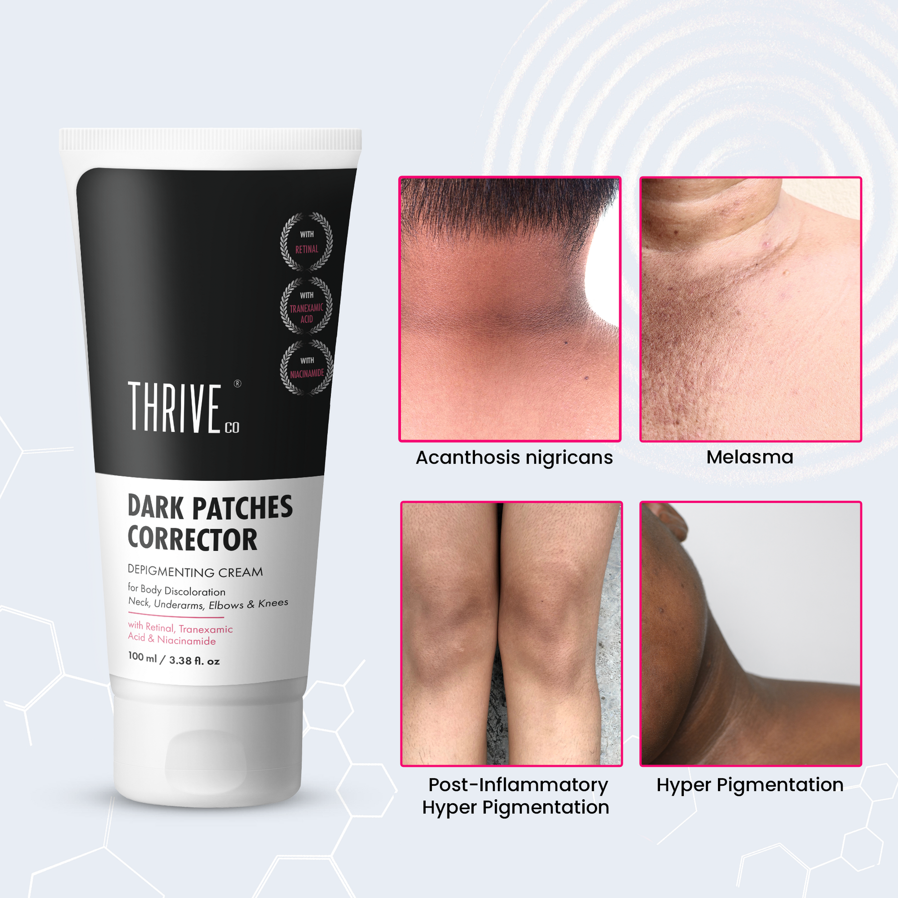 dark patches removal cream
